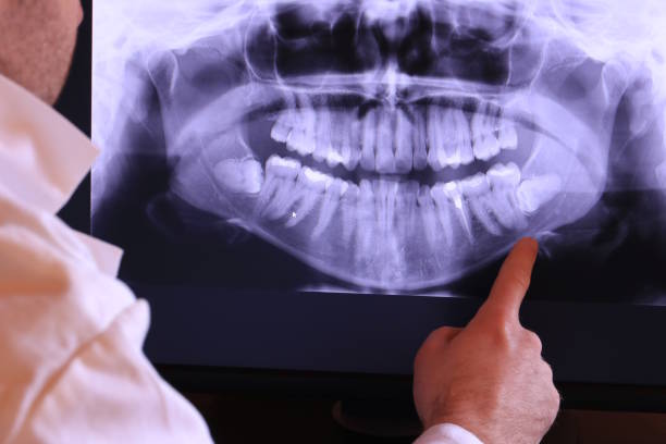 Best Emergency Orthodontic Services in Bourbon, IN